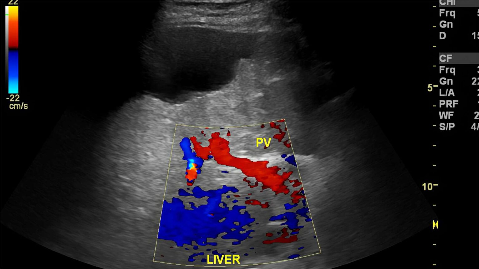 Conheça as diferenças entre o ultrassom doppler e o convencional